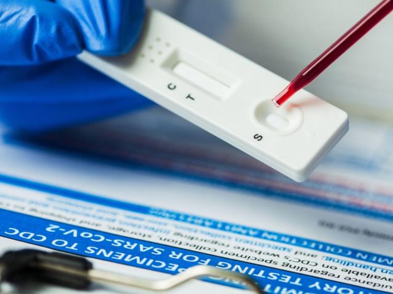 Appello dell'assessore Savaglio al personale della scuola per effettuare i test sierologici